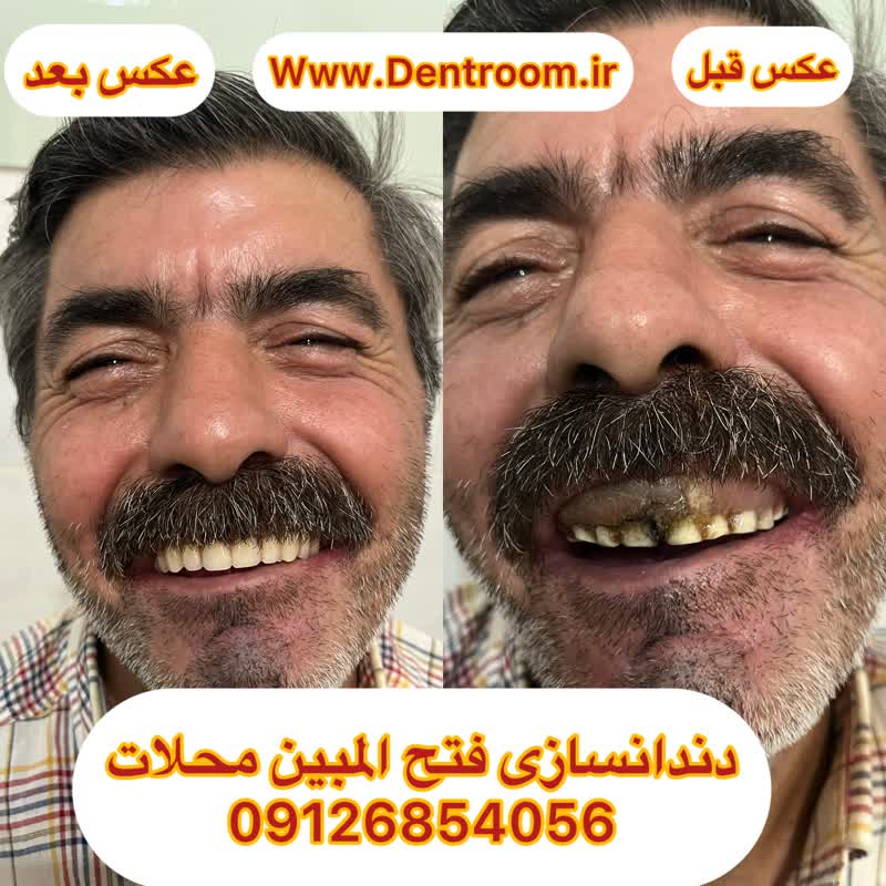 شماره تلفن دندانسازی محلات