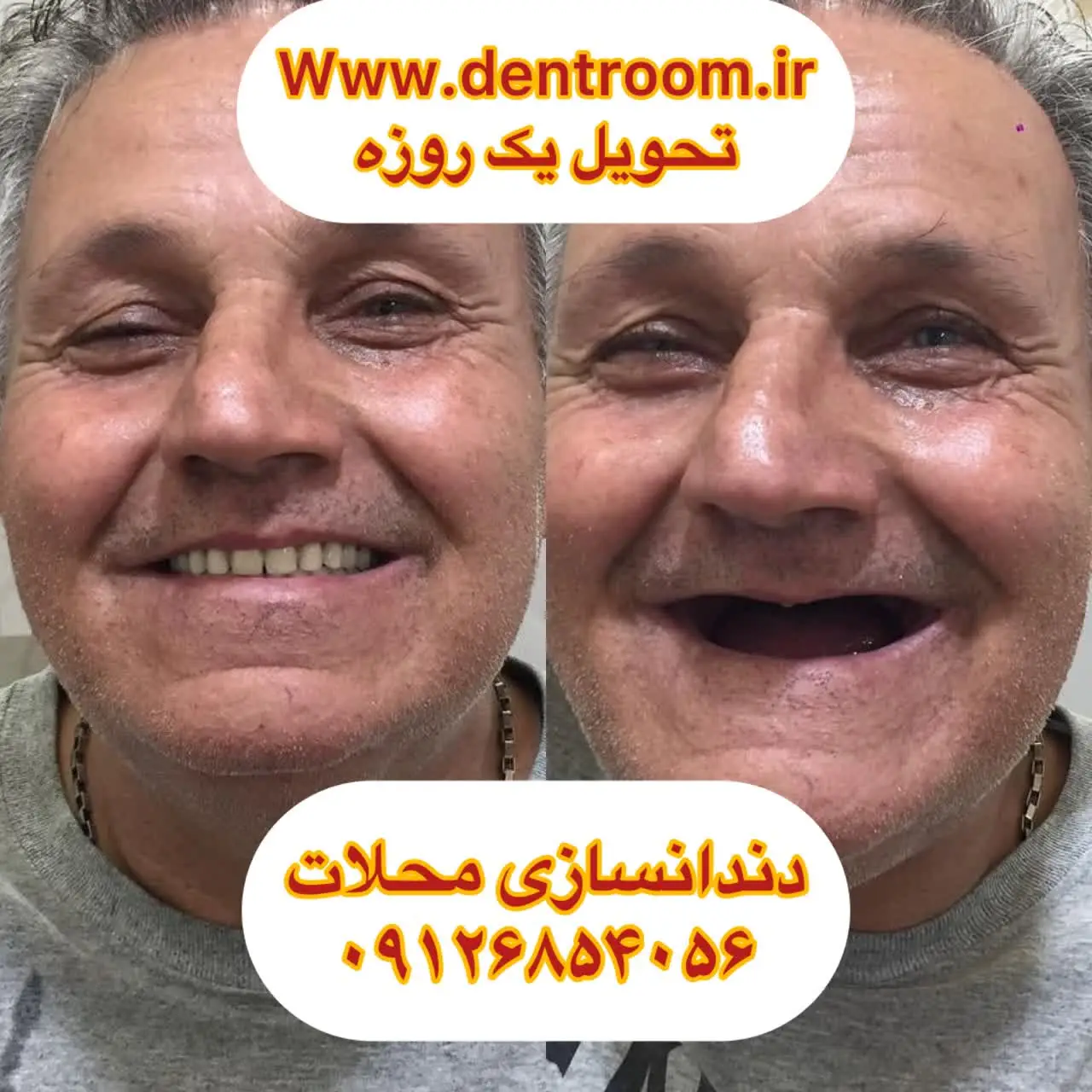 دندانسازی محلات