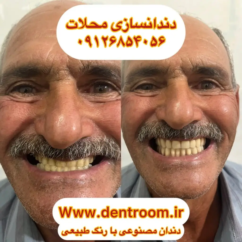 بهترین دندانساز محلات