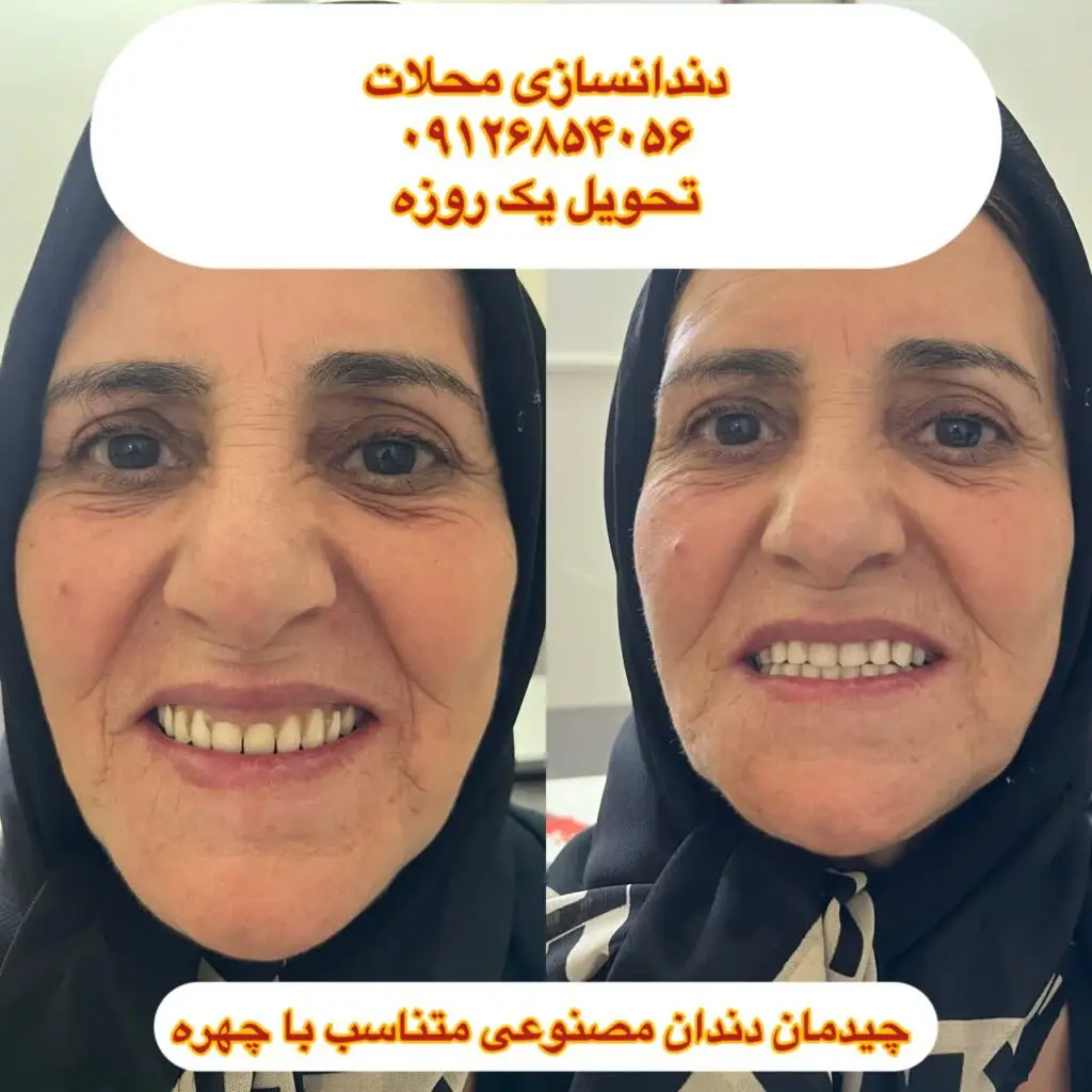 بهترین دندانساز محلات