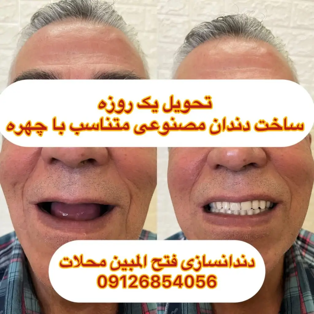 شماره تلفن دندانسازی محلات