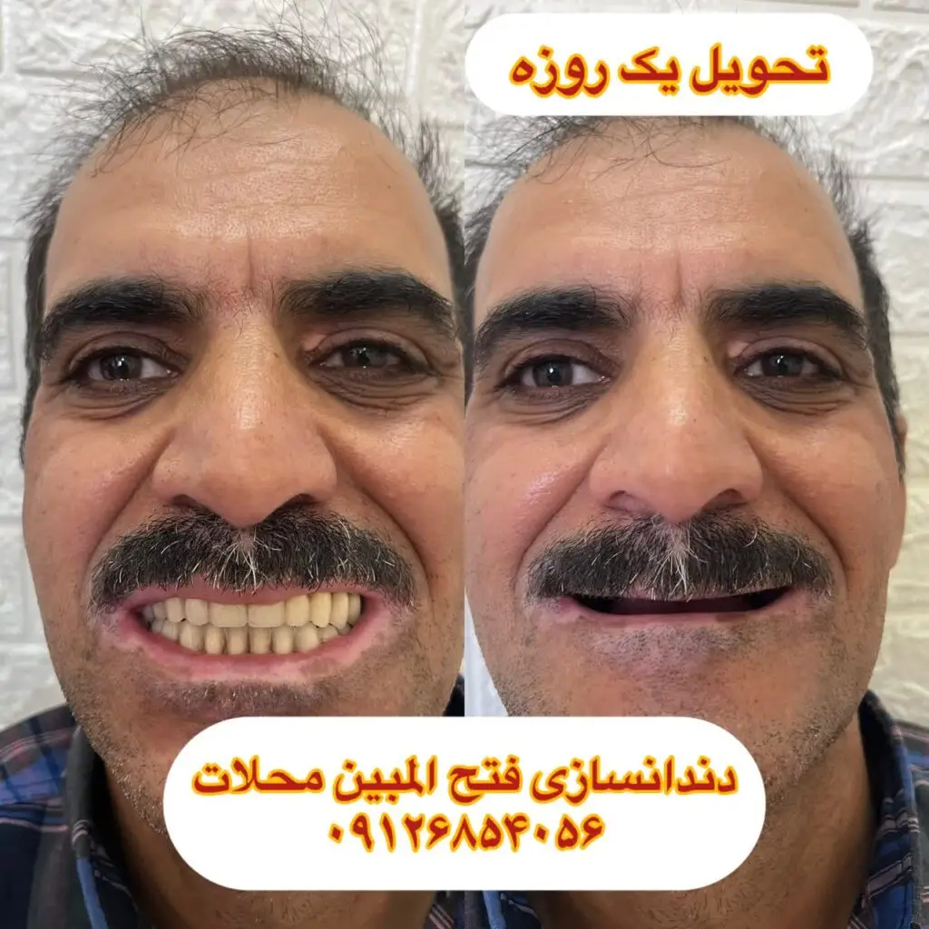 بهترین دندانساز محلات